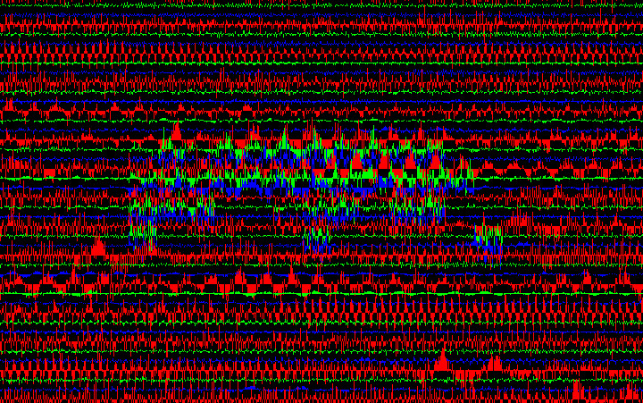 datengraphie: die welt ist schlimm: Spatzenhirne. 02.03.2018 / 329*329 Daxel.